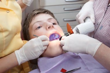 Dental Sealants for Adults: Not Just for Kids—Preserve Your Teeth at Any Age